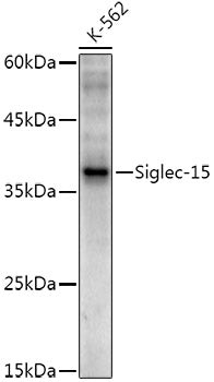 Siglec-15 Rabbit mAb