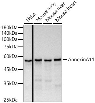 Annexin A11 Rabbit mAb