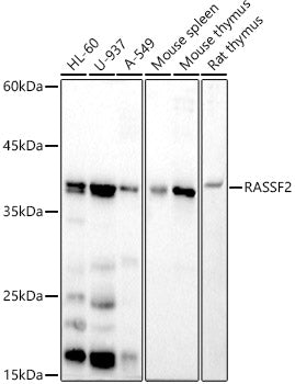 RASSF2 Rabbit mAb