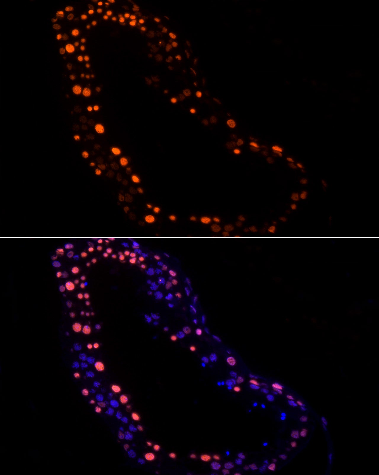RBMXL2 Rabbit mAb