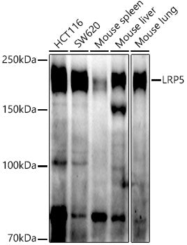 LRP5 Rabbit mAb
