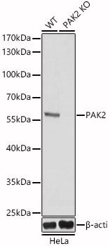 [KO Validated] PAK2 Rabbit pAb