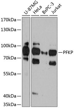 PFKP Rabbit pAb