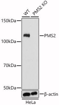 [KO Validated] PMS2 Rabbit pAb