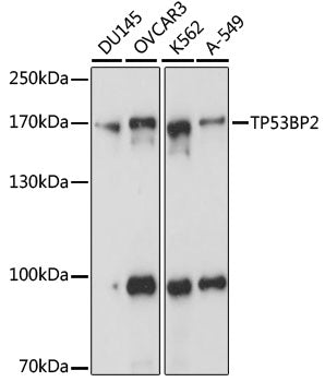 TP53BP2 Rabbit pAb