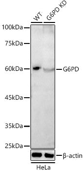 [KD Validated] G6PD Rabbit pAb