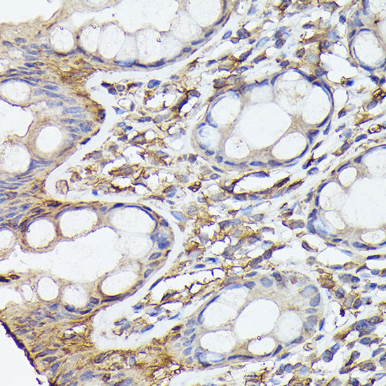 NF-kB p65/RelA Rabbit mAb
