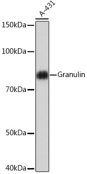 Granulin Rabbit mAb