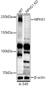 [KD Validated] NPHS1 Rabbit pAb