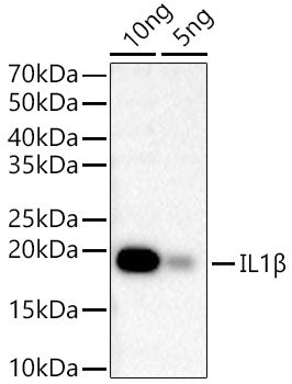 IL1β Rabbit mAb