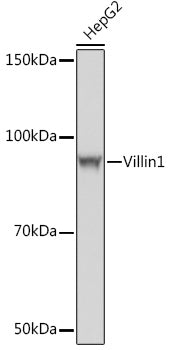 Villin1 Rabbit mAb