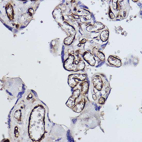 Tryptophanyl-tRNA synthetase 1 Rabbit mAb