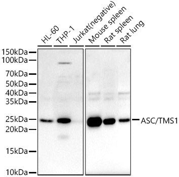 ASC/TMS1 Rabbit pAb