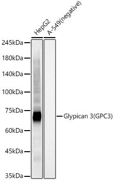 Glypican 3 (GPC3) Rabbit mAb