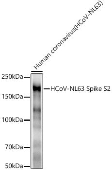 HCoV-NL63 Spike S2 Rabbit mAb