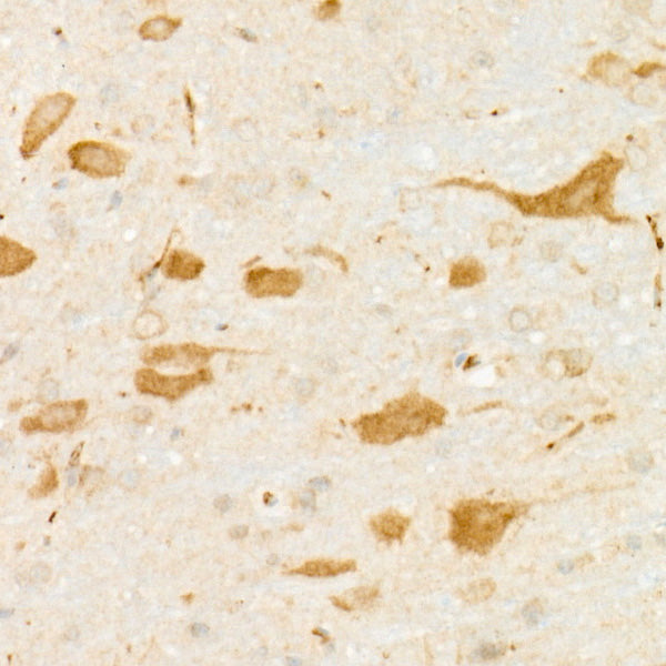 DARPP32 Rabbit mAb