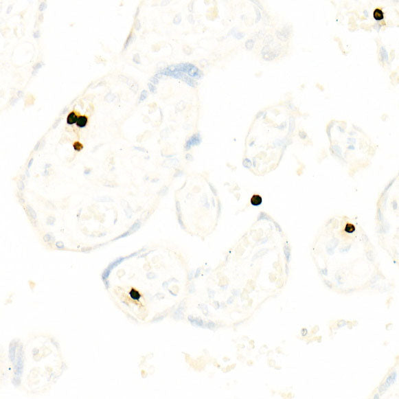 CD66b/CEACAM8 Rabbit mAb