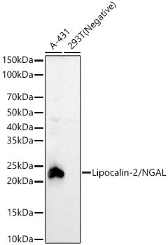 Lipocalin-2/NGAL Rabbit mAb