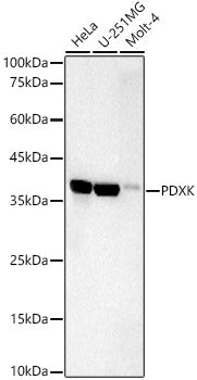 PDXK Rabbit mAb