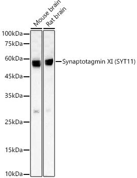 Synaptotagmin XI (SYT11) Rabbit mAb