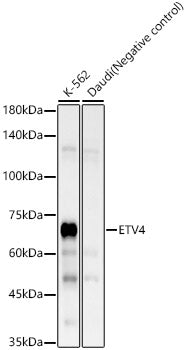 ETV4 Rabbit mAb