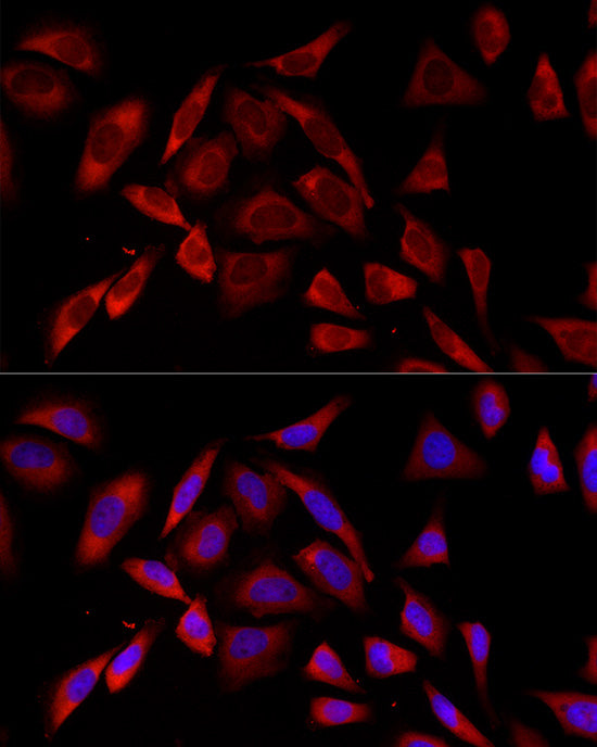 PKC alpha Rabbit mAb