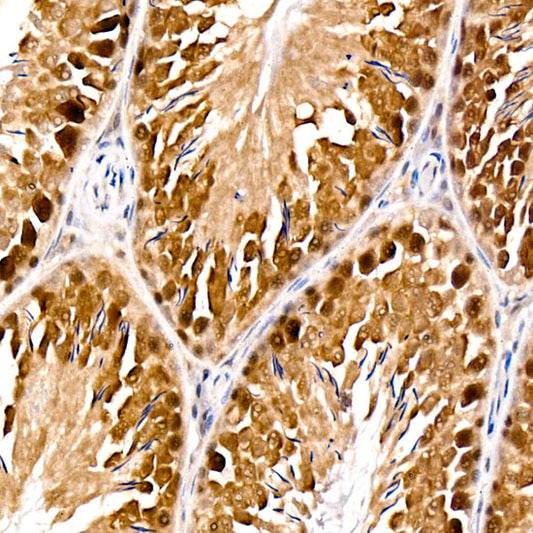 PARG  Rabbit mAb