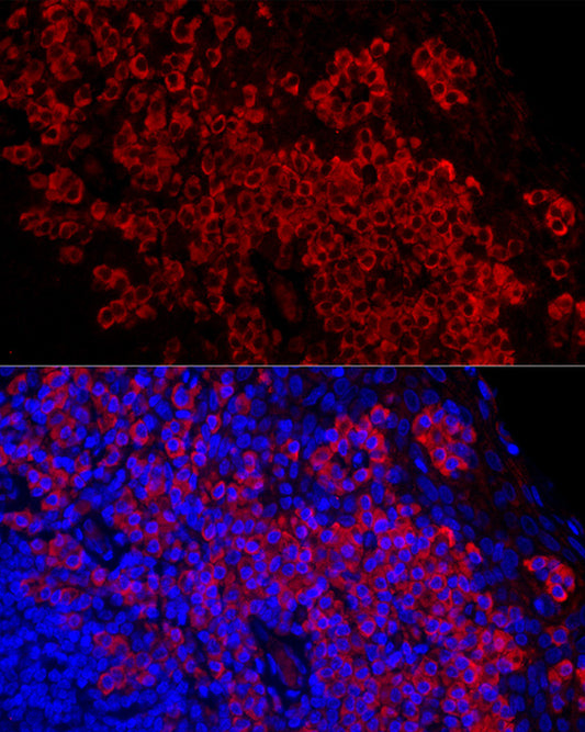 DARC Rabbit mAb