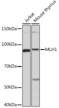 MLH1 Rabbit mAb
