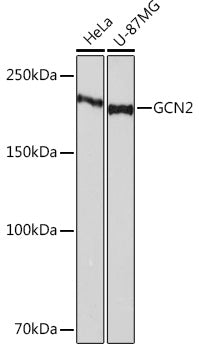 GCN2 Rabbit mAb