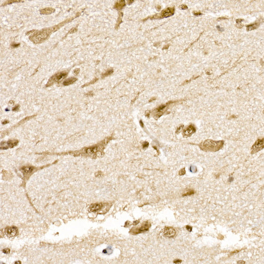 SOCS7 Rabbit mAb