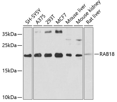 RAB18 Rabbit pAb