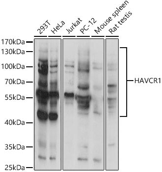 HAVCR1 Rabbit pAb