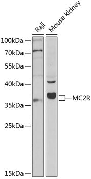 MC2R Rabbit pAb