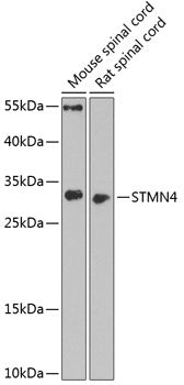 STMN4 Rabbit pAb