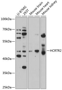 HCRTR2 Rabbit pAb