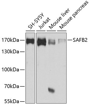SAFB2 Rabbit pAb