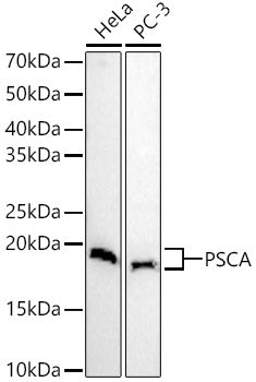 PSCA Rabbit pAb