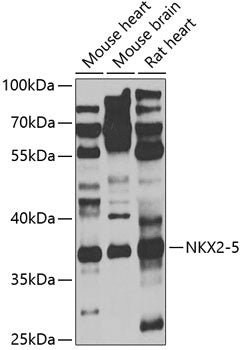 NKX2-5 Rabbit pAb