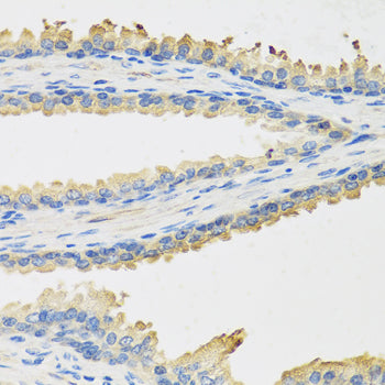 Leptin Rabbit pAb