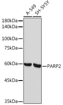 PARP2 Rabbit mAb