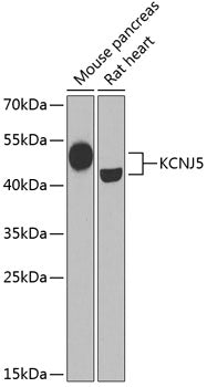 KCNJ5 Rabbit pAb
