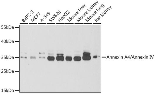 Annexin A4/Annexin IV Rabbit pAb