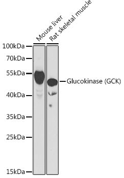 Glucokinase (GCK) Rabbit pAb