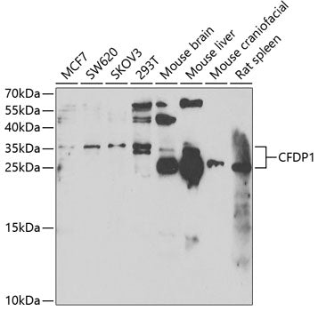 CFDP1 Rabbit pAb
