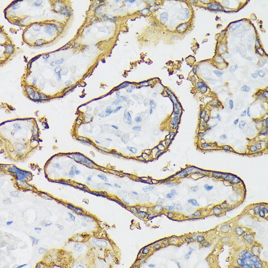 Placental alkaline phosphatase (PLAP) Rabbit pAb