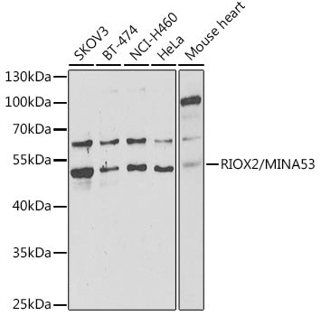 RIOX2/MINA53 Rabbit pAb