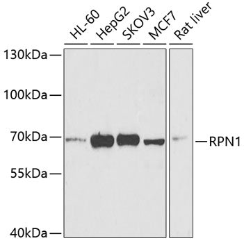 RPN1 Rabbit pAb
