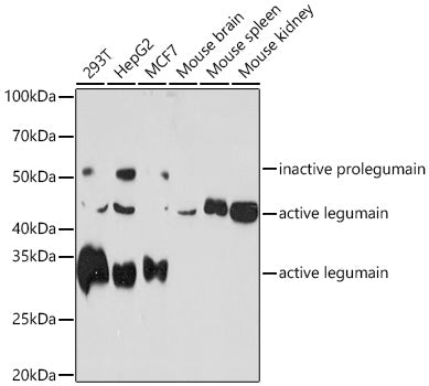 Legumain (LGMN) Rabbit mAb