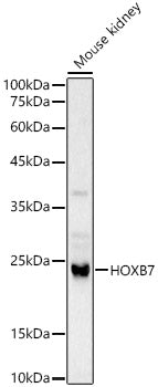 HOXB7 Rabbit pAb
